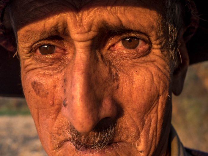 Ensayo sobre la ceguera, cirugía de cataratas en Tarija (Bolivia). Fundación Ojos del Mundo.